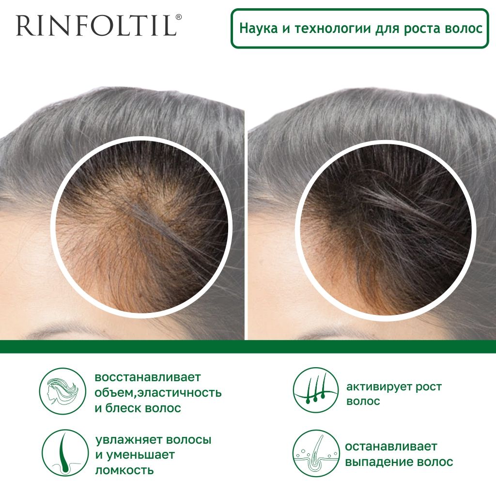 Rinfoltil Сыворотка для интенсивного роста волос, липосомальная сыворотка, 30 шт.