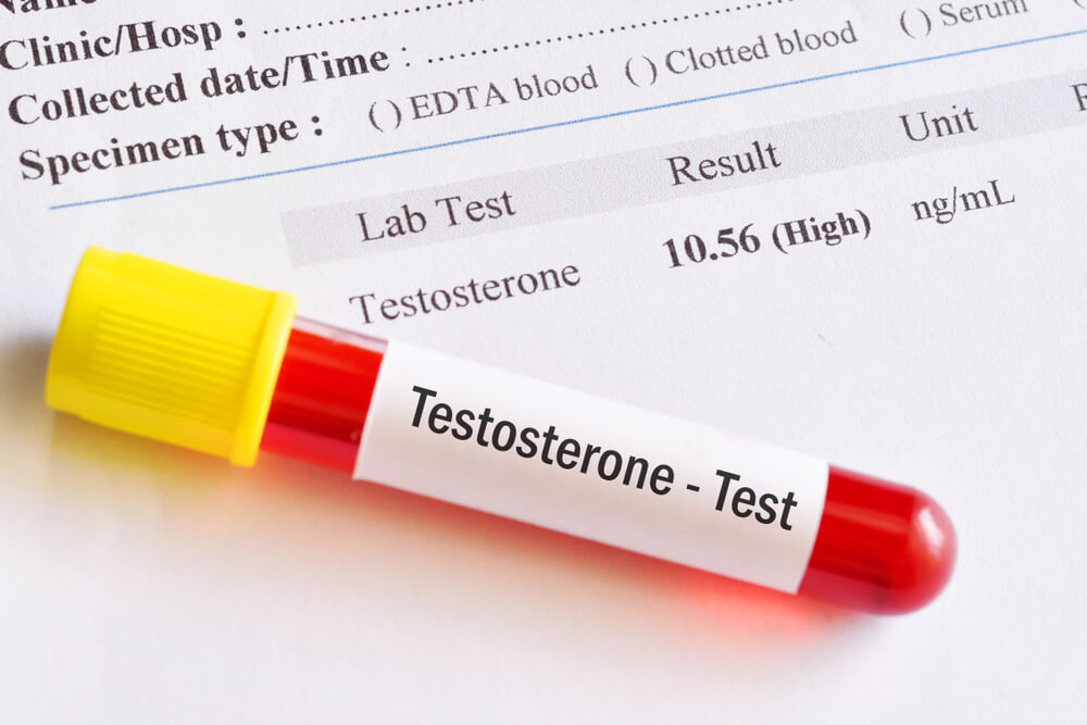 Симптомы низкого тестостерона