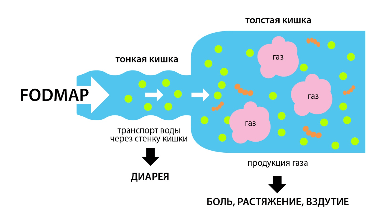 Синдром раздраженного кишечника (СРК) | Kyiv Clinic