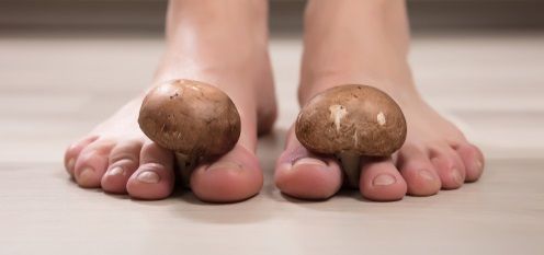 Как вылечить грибок на коже и ногтях?
