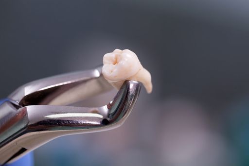 Что можно и нельзя после удаления зуба? 
