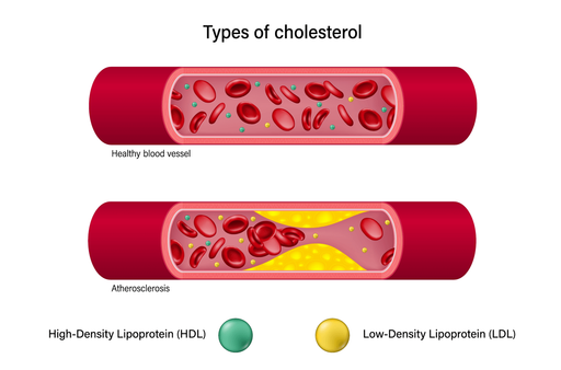 Уровень холестерина в крови: норма у мужчин и женщин