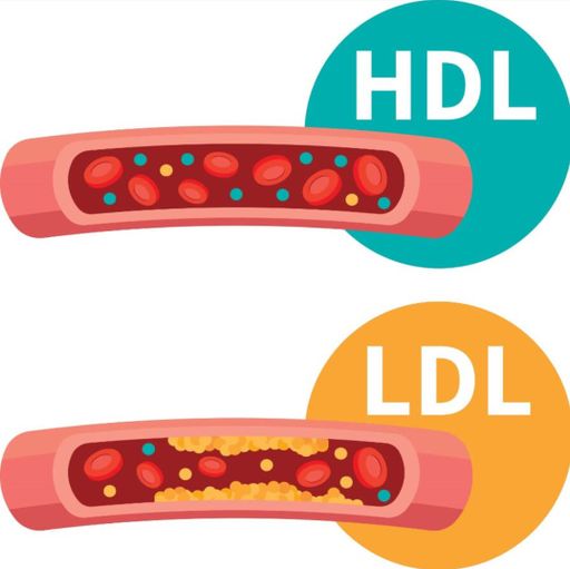 Холестериновая дилемма: как балансировать LDL и HDL