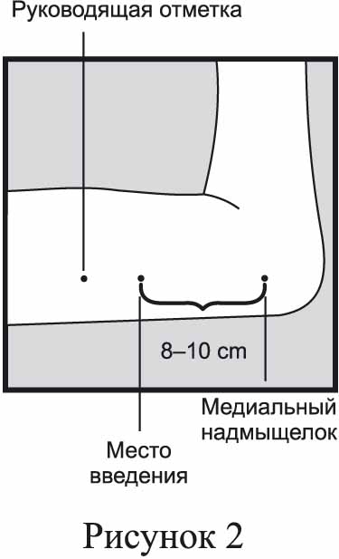 Инструкция по применению Импланон НКСТ, 68 мг, 1 шт. - схема 2